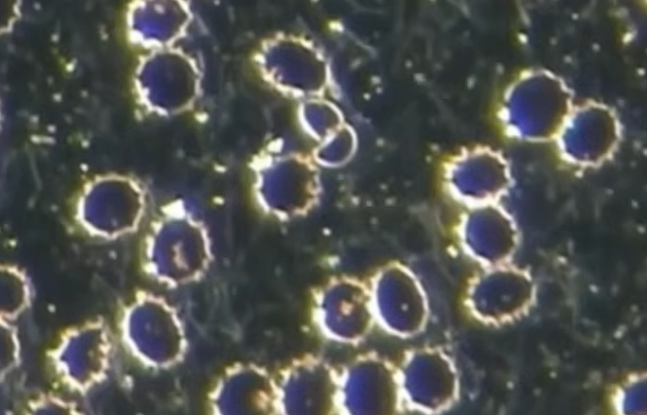 Observation microscopique du sang : microzymas et bactéries